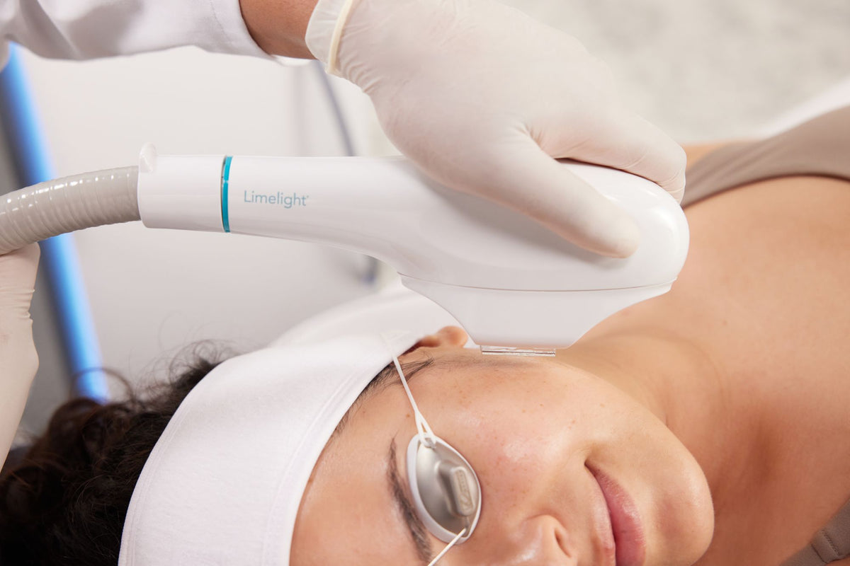 The Complete Guide to Laser Skin Rejuvenation in Auckland: What It Is, Who It's For, and What to Expect
