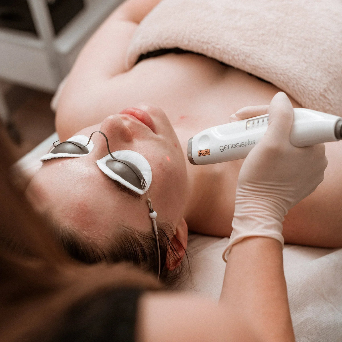 Why About Skin Chooses Cutera and Candela Systems Over Generic IPL or BBL Devices
