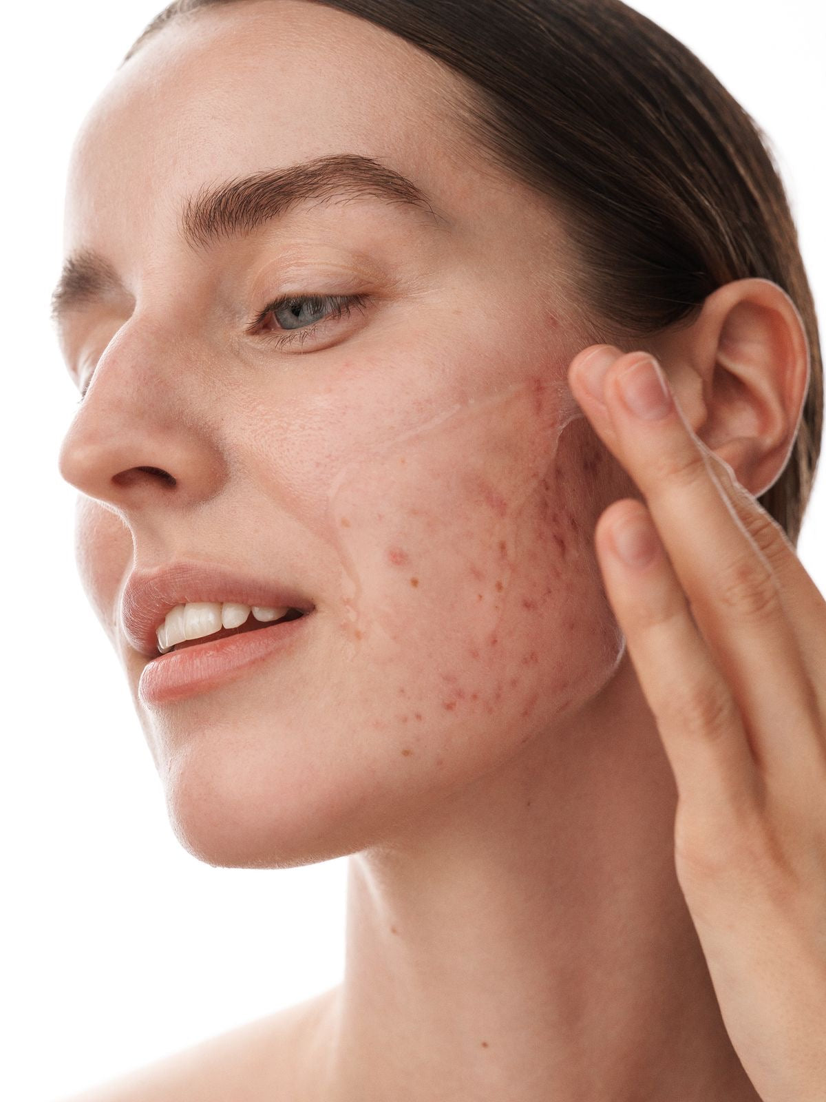 Top Skincare Clinic in Auckland